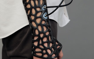 The printed ultrasound cast