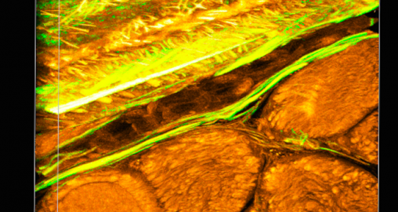 Smart fabric mimics bone tissue periosteum that stiffens upon impact