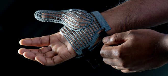 A 3D printed glove to prevent musculoskeletal disorders