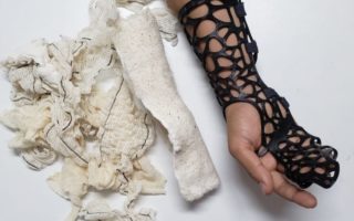 Biodegradable 3D printed splints as alternative to a cast