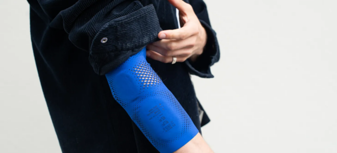 An elbow brace made with 3D printing and laser-cutting