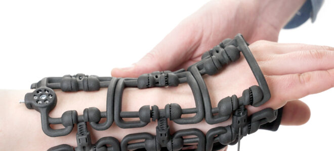 Bracesys: A Modular Orthopaedic Brace System Based On Adaptive Design
